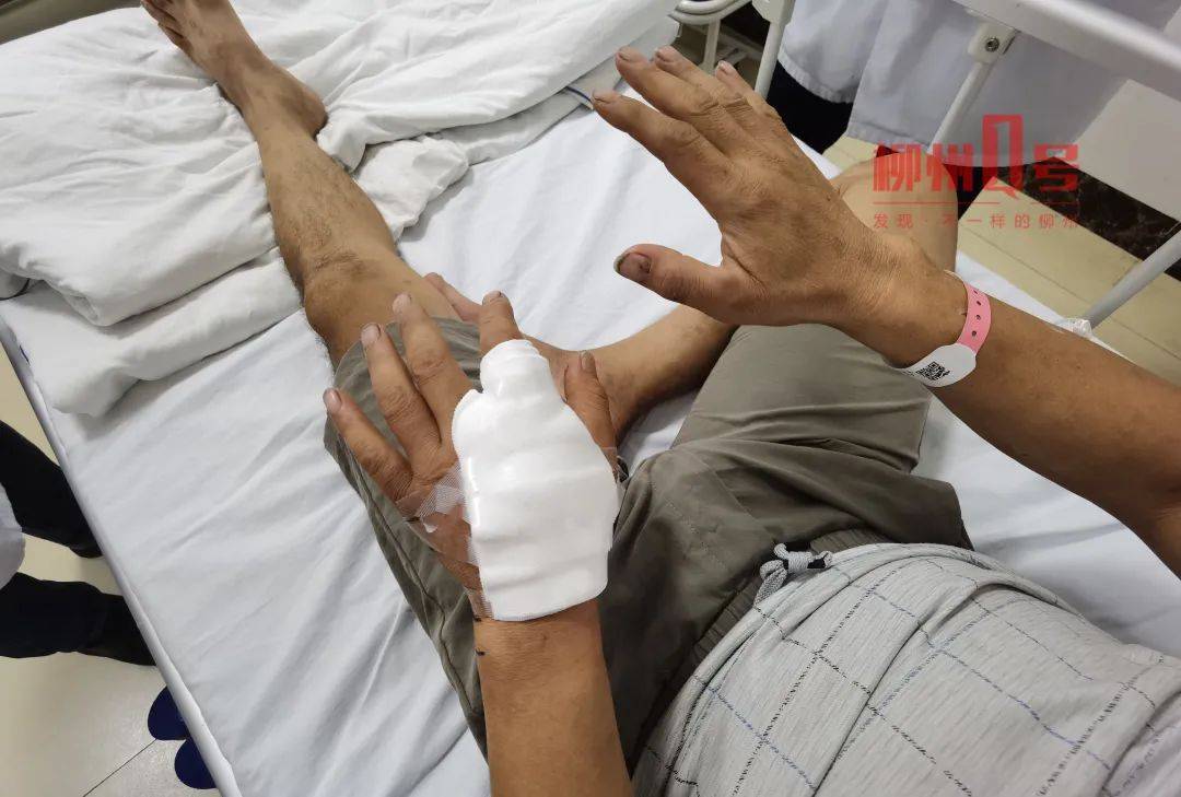 救治|电动车骑手碾到毒蛇后立马被反咬，昏迷两天！医生紧急提醒