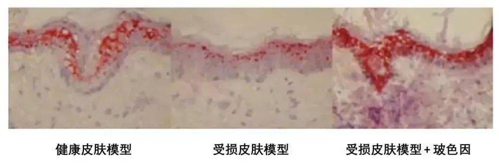 眼睛眼睛往往是暴露衰老的罪魁祸首！一个女人的风情，全蕴含在眼睛里~