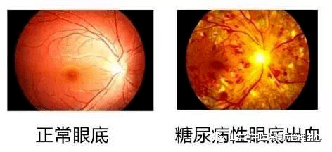 be7552b89c204ee59c6a98cb1fe81326.png