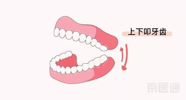 要点|这6个动作天天练，可能帮你省下一大笔医药费