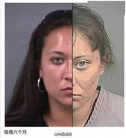 还不止于此,除了能导致急性健康问题和精神依赖外,还会造成吸食者死亡