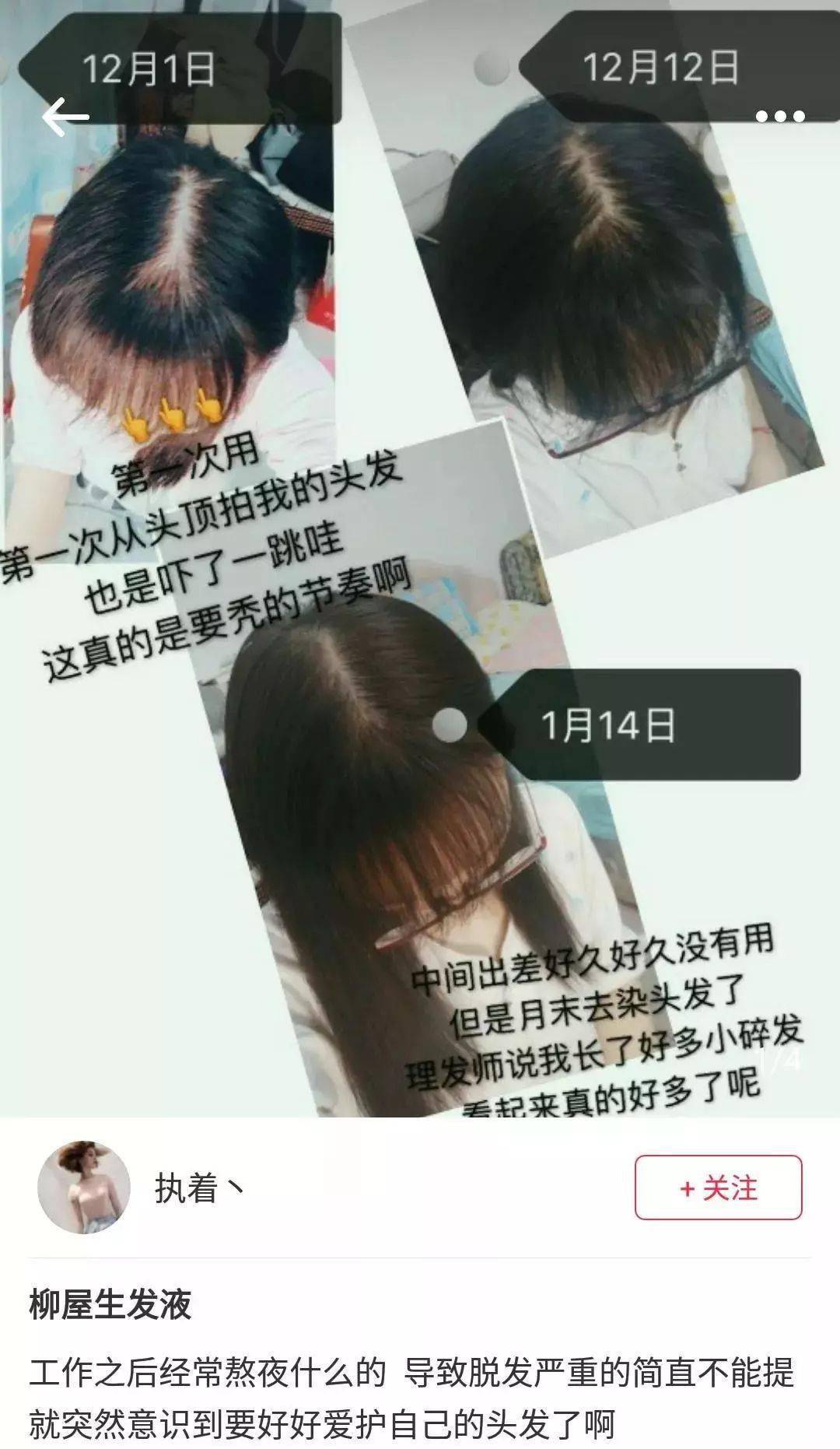 发型为了拯救发际线，日本人可是绞尽脑汁！