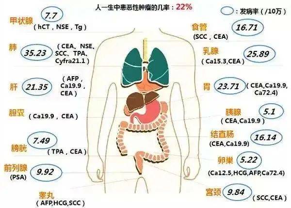 恶性肿瘤|教你如何看懂体检报告