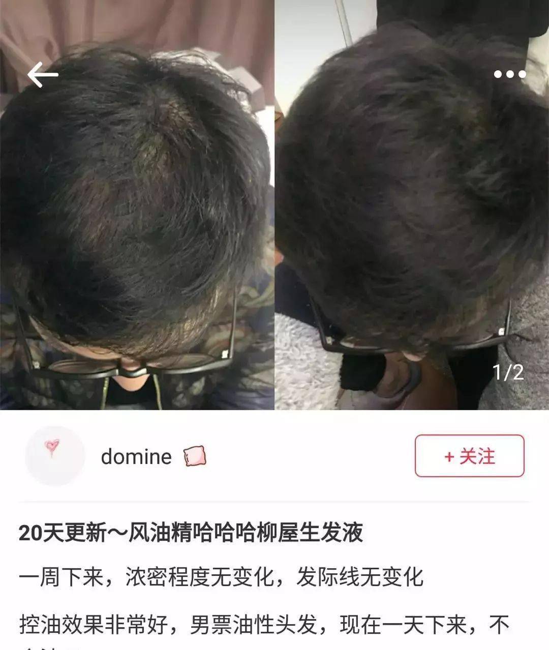 发型为了拯救发际线，日本人可是绞尽脑汁！