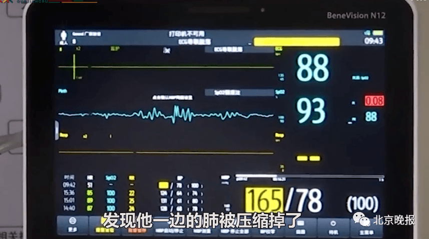 来源|吓坏！男子含了颗话梅睡觉，结果差点丧命