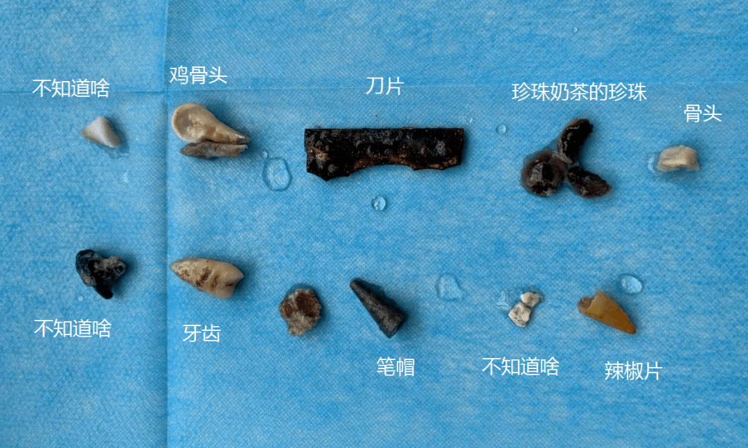 来源|吓坏！男子含了颗话梅睡觉，结果差点丧命