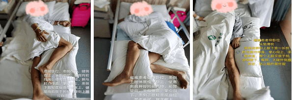 除病情及治疗需要外,避免患者长时间处于床头抬高超过30°;侧卧位时