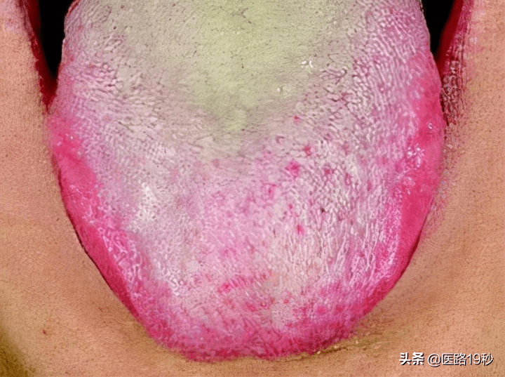 95e23f54516a4be1b812908c401e19cc.png