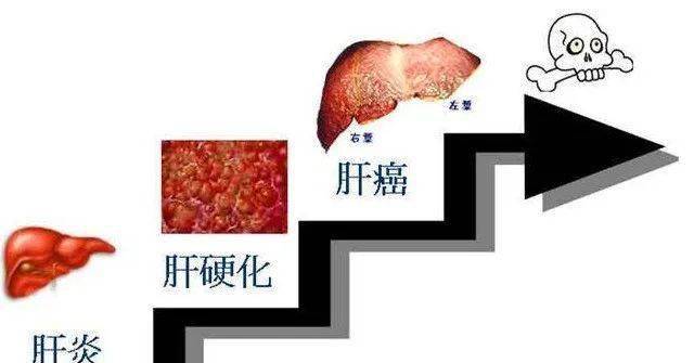 水平|科普 | 防治乙肝最关心的6个问题，答案在这里！