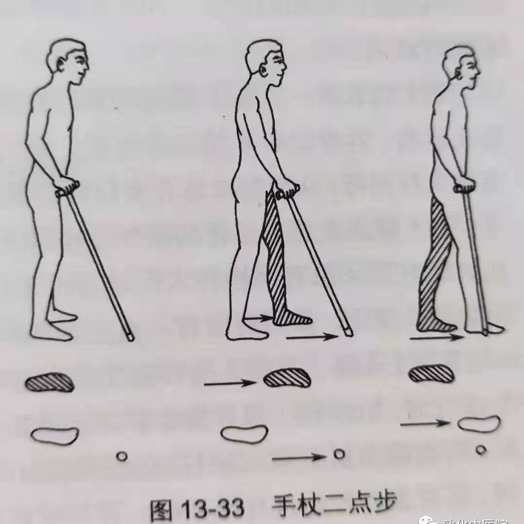 脑卒中康复的步行训练_患者