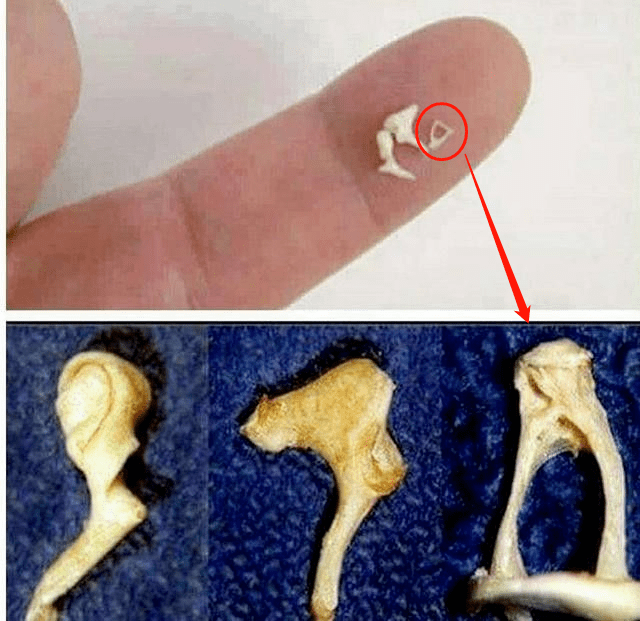 警惕!耳鸣,眩晕,听力下降......可能是人体最小的骨头罢工了!_老朱