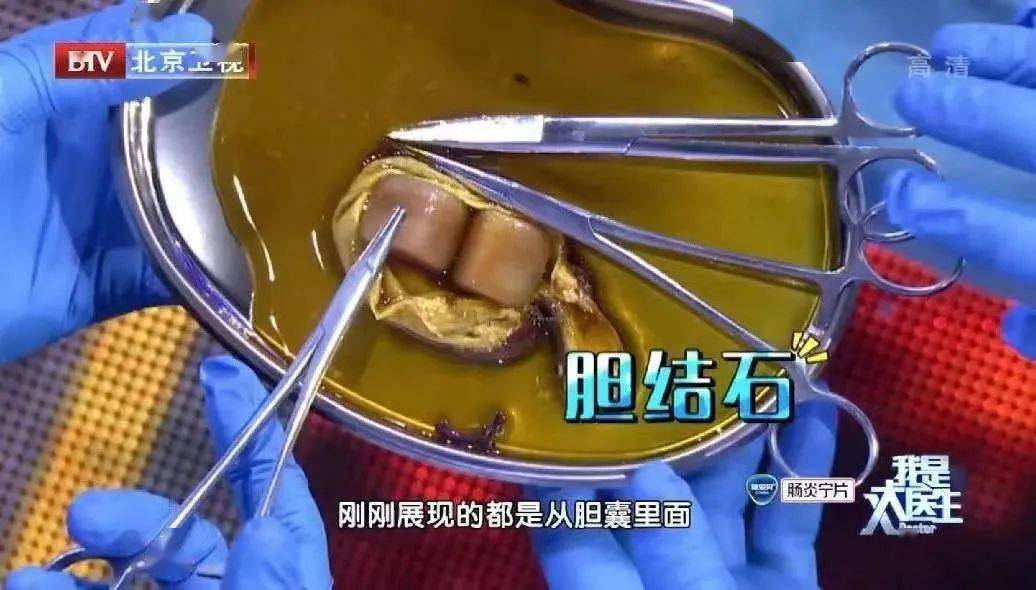 空腹|【健康】几点吃早饭？睡回笼觉好不好？这些疑问，看完就不纠结了！