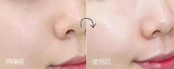 黑头获得世界品质评鉴大奖的洁颜泥，日本模特、艺人大爱，黑头、角质、粉刺用它都能搞定！