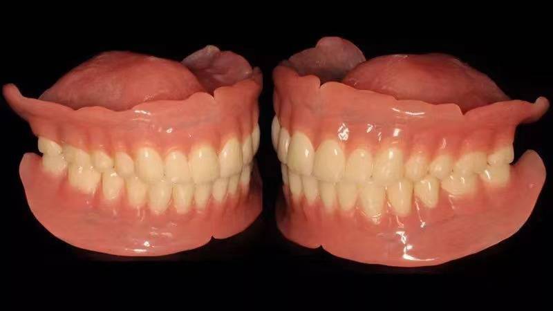 18岁50岁缺牙人群请注意这四种缺牙修复方法教你正确选择