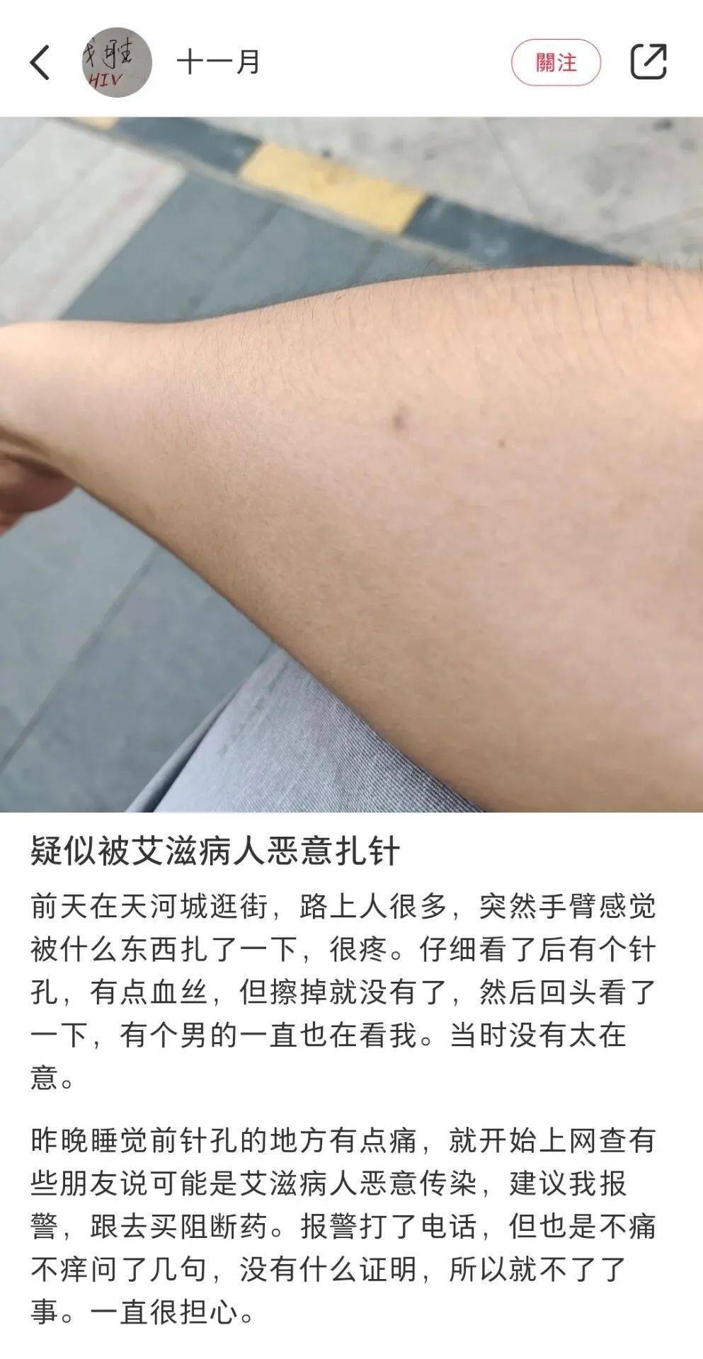 两网友称在广州街头被扎针:恶意扎人需要承担的法律后果