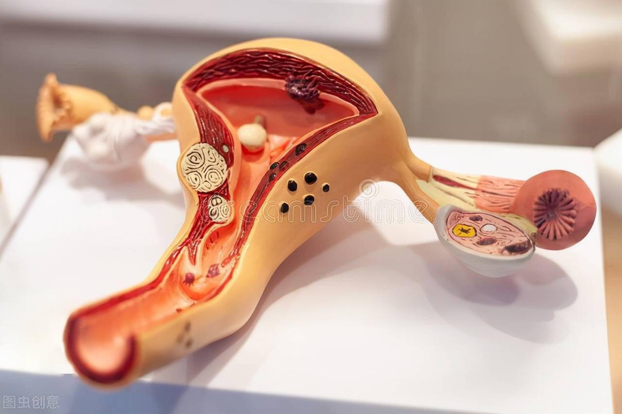 你的卵巢输卵管和子宫还健康吗守护3个器官贯穿女性一生