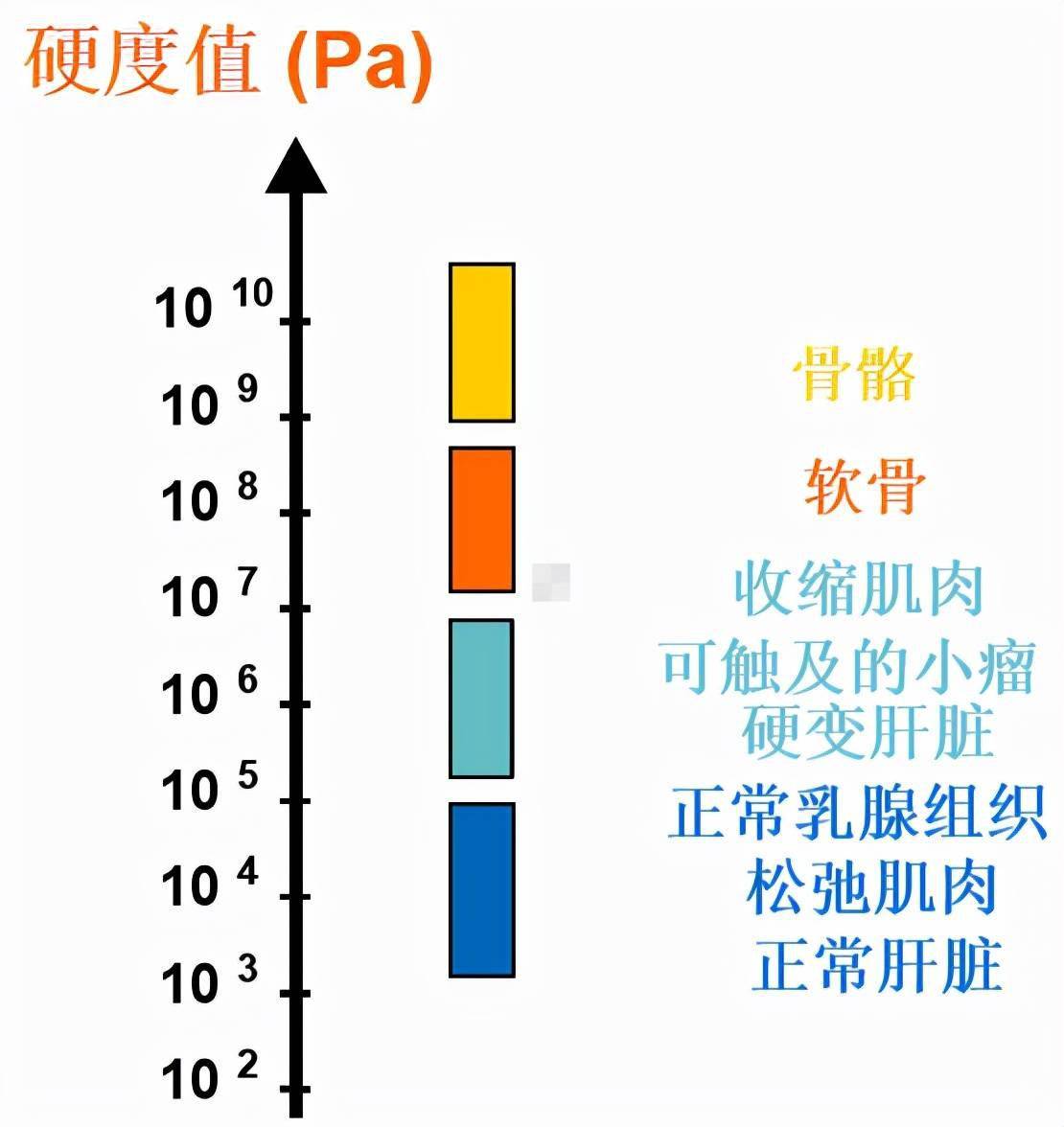 应用瞬时弹性剪切波对肝组织进行测量,肝脏的硬度值与弹性剪切波在