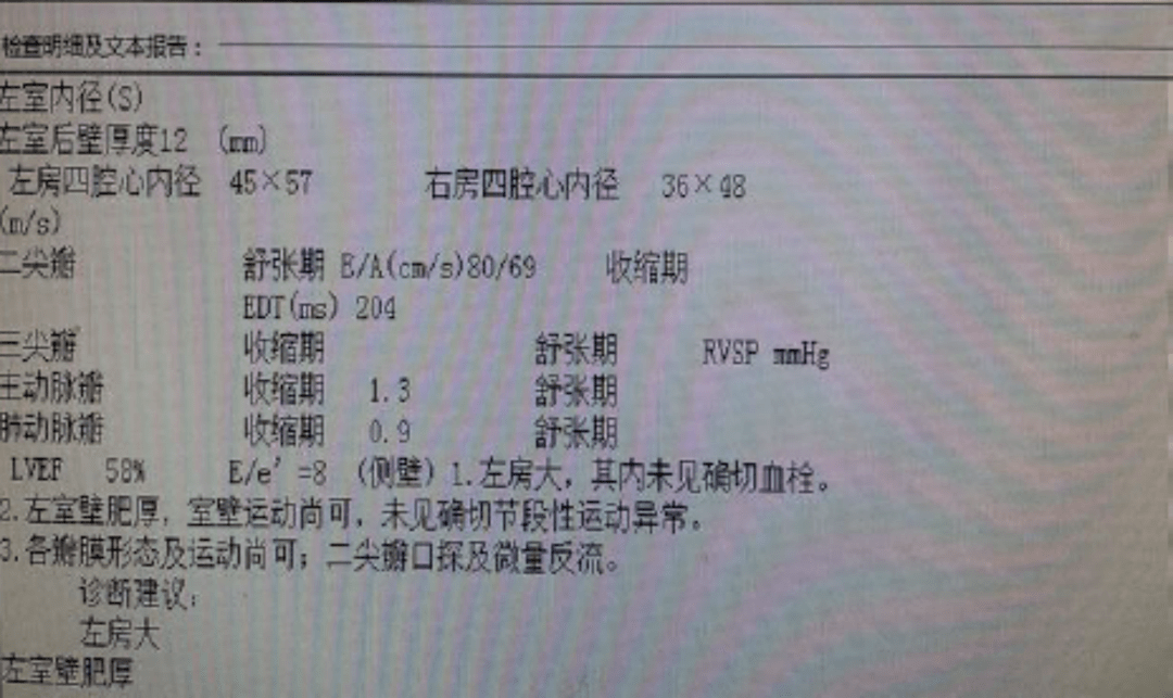 9ff8765e255a406a85ceceacc36e8b20.png