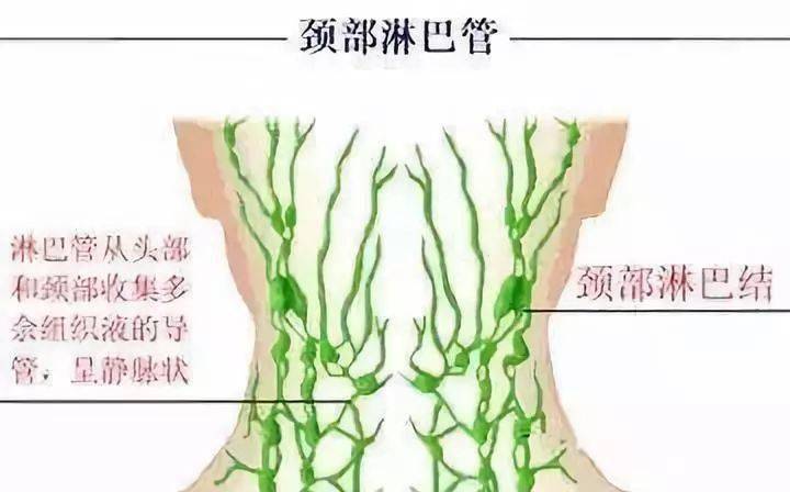 颈部淋巴决定头部疾病!