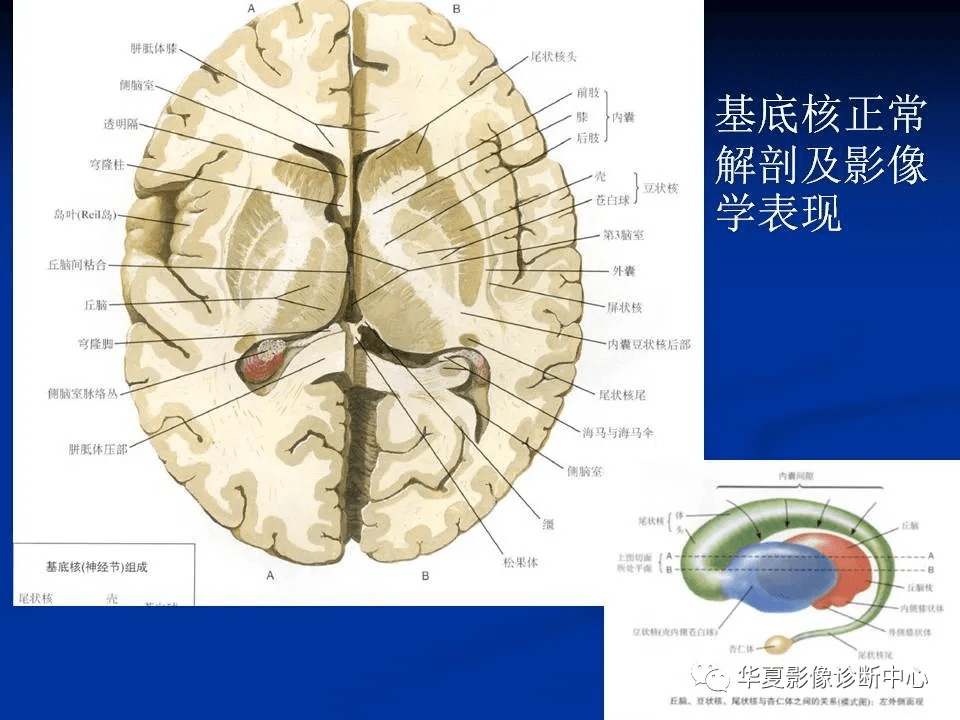 头颅ct基底节区解剖图图片