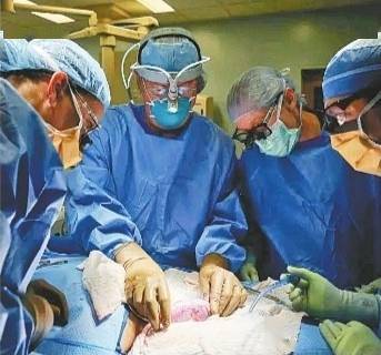 豬腎成功移植人體 「世界首例」離不開這位華人女科學家 科技 第2張