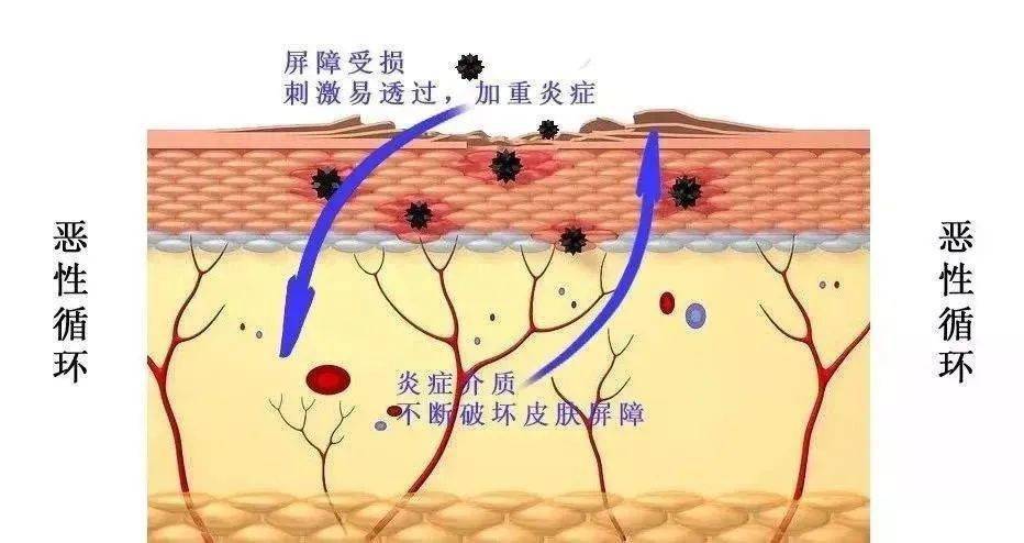 补充全国皮肤科榜首的华山医院，一个面霜做了3年，推迟又推迟