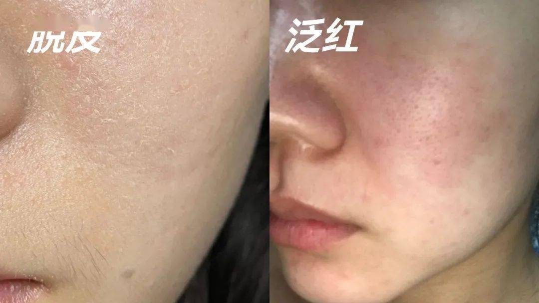 产品双十一│这个种草清单写了你的名字！