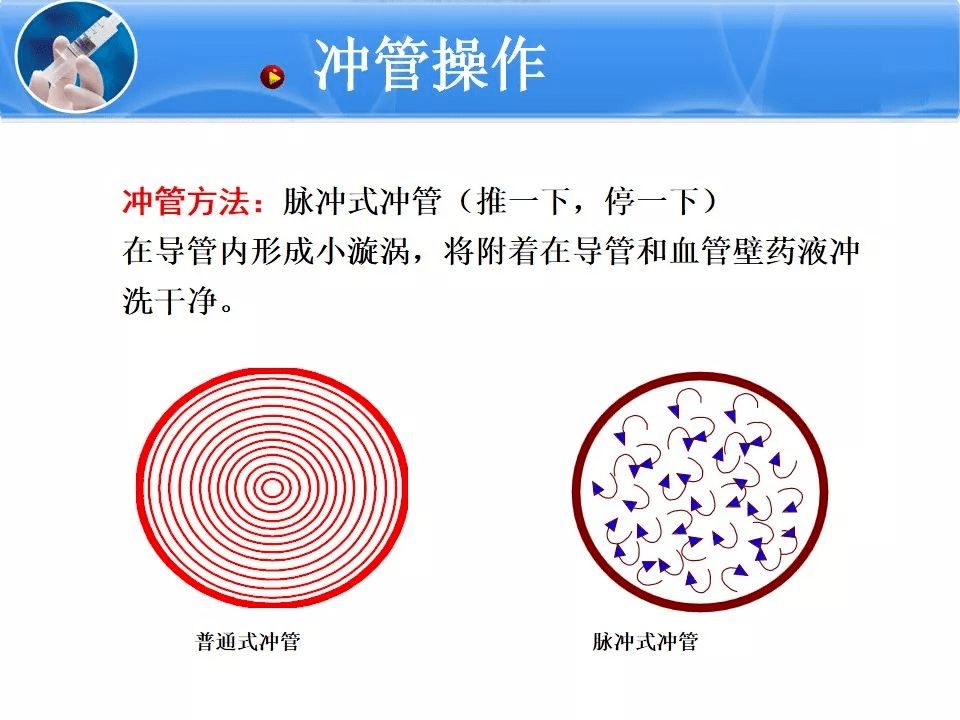 注有阻力,回抽无回血,立刻给予用10ml预充式导管冲洗器进行脉冲式冲管