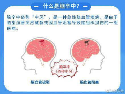 联合国|中风是全球人口第二大死因