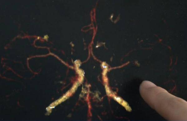 同事|18岁小伙一觉醒来脑中风，这个诱因很多人都会有