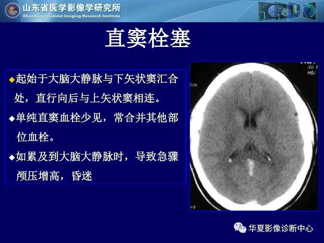 诊断|缺血性脑血管病的影像诊断