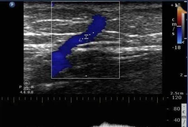 转科|男子每天腿上都像穿着“豹纹袜”！皮肤科医生建议他转科