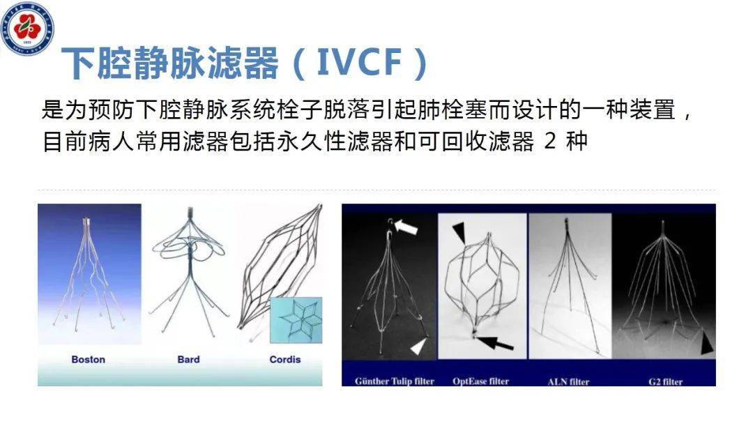 【ppt】下腔静脉滤器置入术围术期护理查房_直播