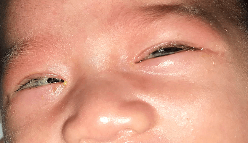 为什么有些眼病从小就有,宝宝却从不告诉父母?家长要牢记这几点!_视力