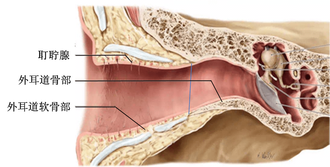 俗称耳屎,耳垢,耳蝉,是外耳道软骨部皮肤(长有耳毛处)耵聍腺的分泌物