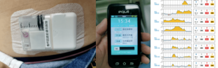 血栓|30岁小伙突然抽搐、昏迷不醒！只因狂喝这个年轻人爱的