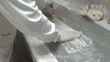 新华社|“丰石膏”的医者仁心