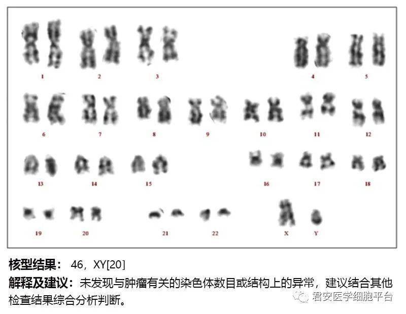 染色体报告单图片