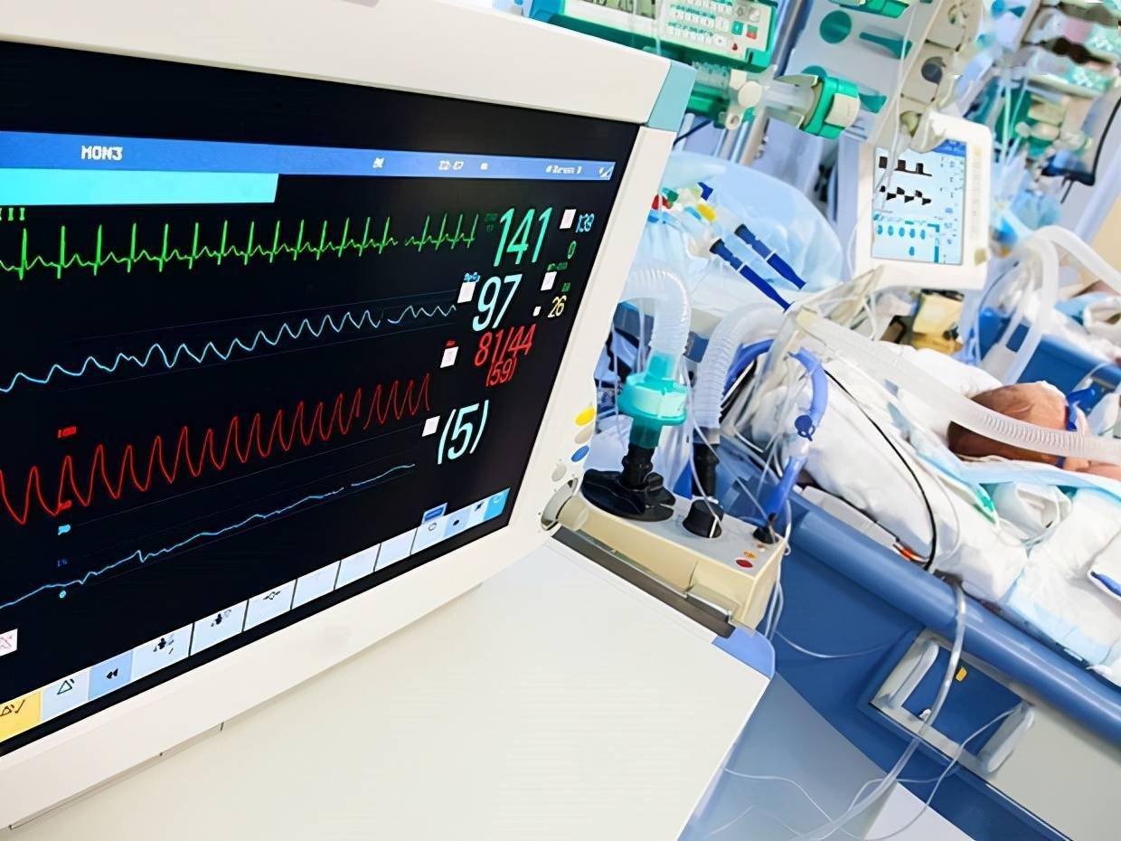 重症监护室平均一天花费上万到底贵在哪里听听医生的解释
