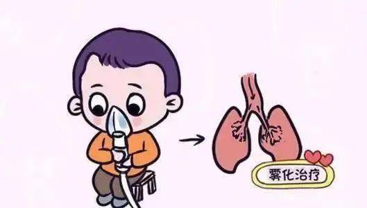 孩子秋冬季咳嗽雾化给药需要注意什么