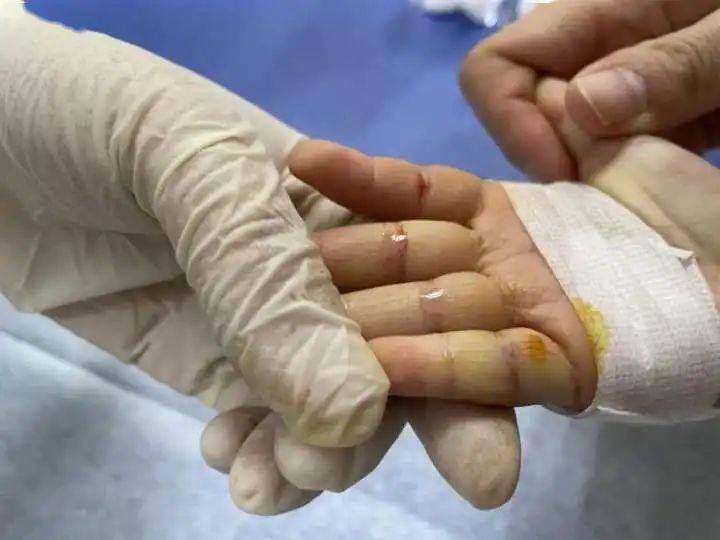 样子|2岁女童反复患肺炎，瘦成这副样子！爸爸说出一个“秘密”，妈妈绷不住了……