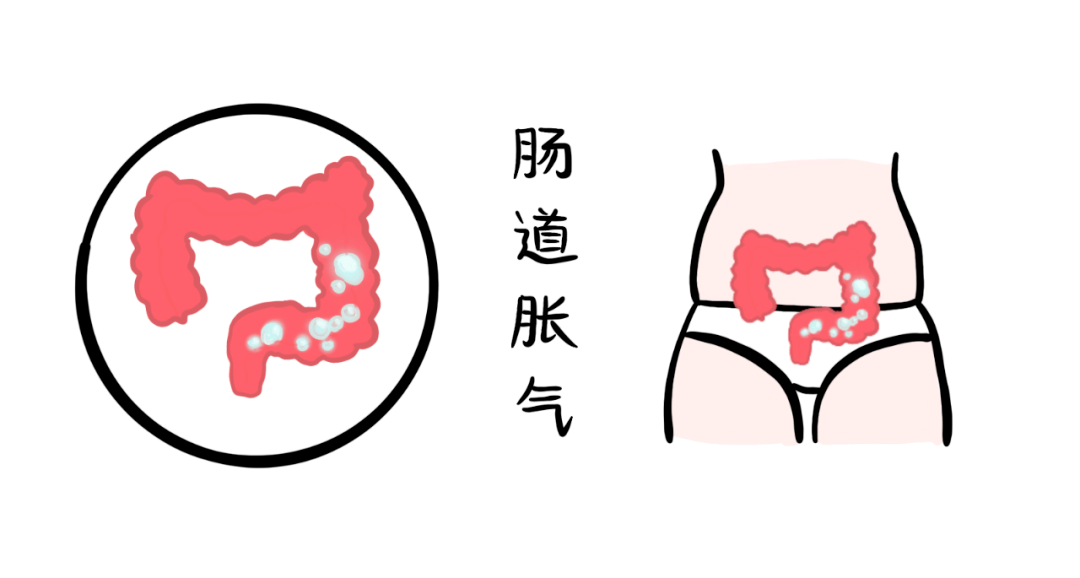 肚子经常胀气难受试试这几招