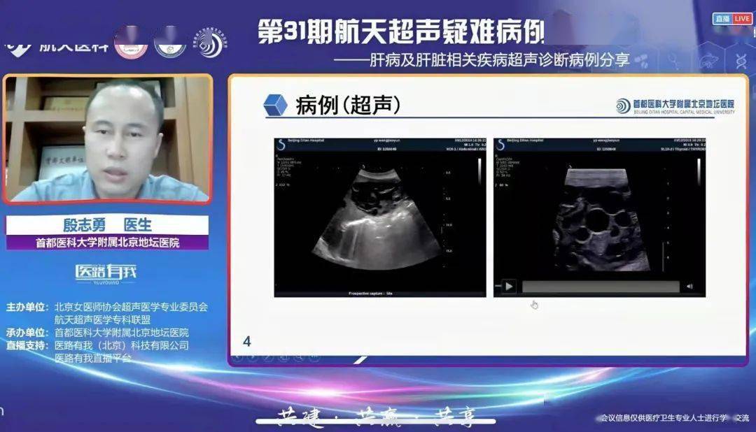 病例|超声疑难病例分享！这场会议在冬日里暖心上线