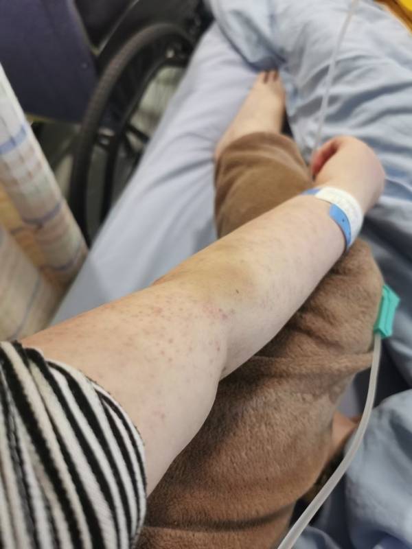 毛坯房里的绝症舞者00后女孩因吃激素药发胖穿唐装跳舞圈粉60万