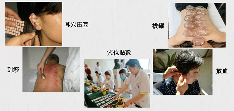 技术|【义诊通知】医院11月22日举办“世界针灸日”义诊活动