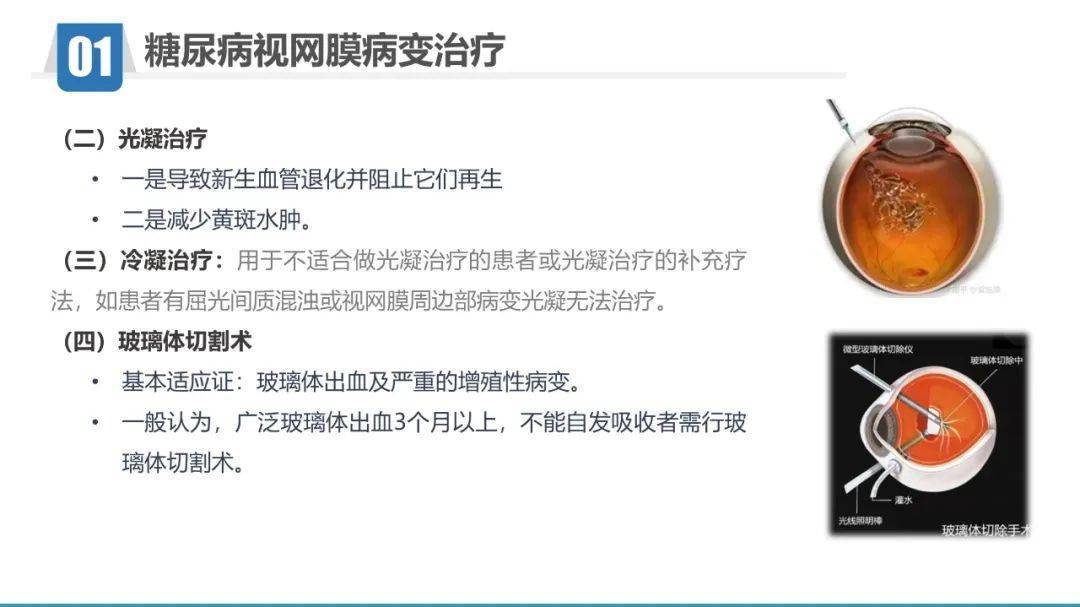 ppt糖尿病视网膜病变护理查房