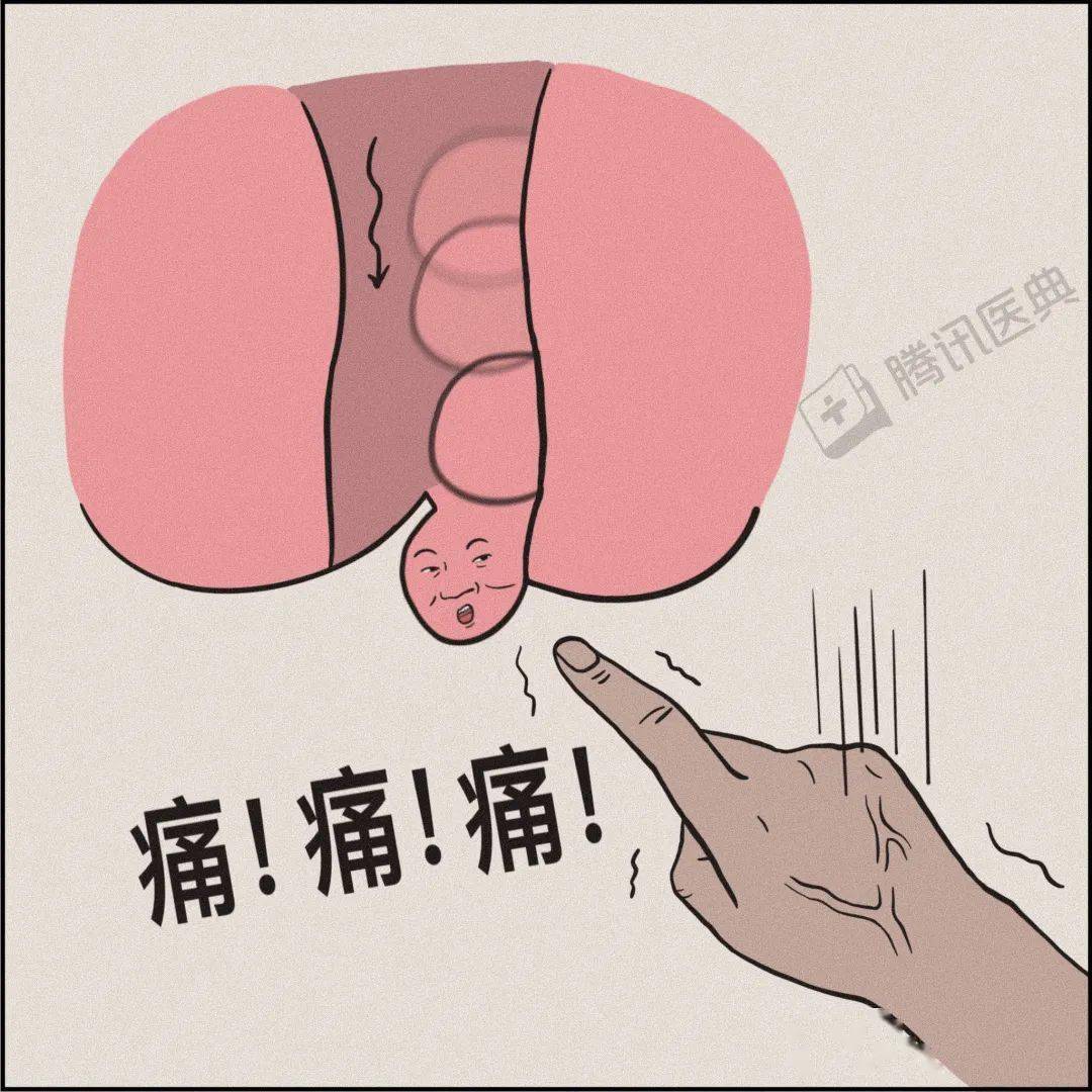 尿道口下边肉球是啥图片