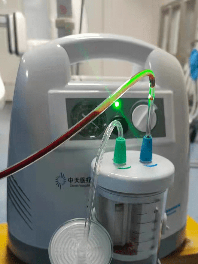 神介种田病例系列丨基底动脉原位重度狭窄基础急性闭塞取栓