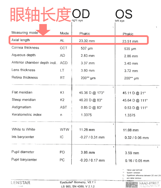 孩子的眼科檢查到底要查些啥為你盤點3種常見特殊眼科檢查