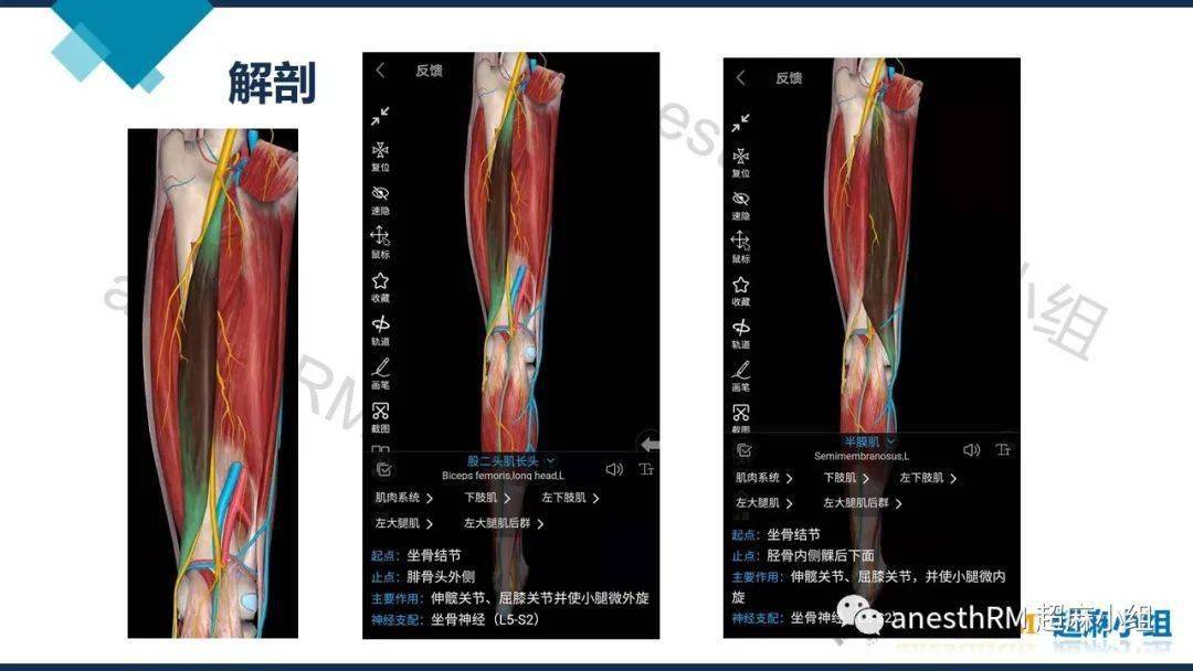 超声引导下腘窝坐骨神经阻滞